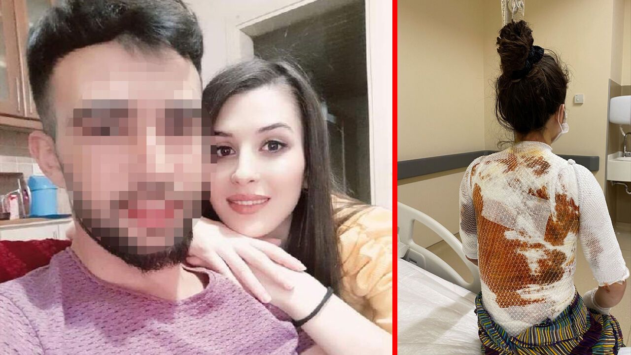 Konya'da eşini kaynar suyla yakan koca serbest bırakıldı!