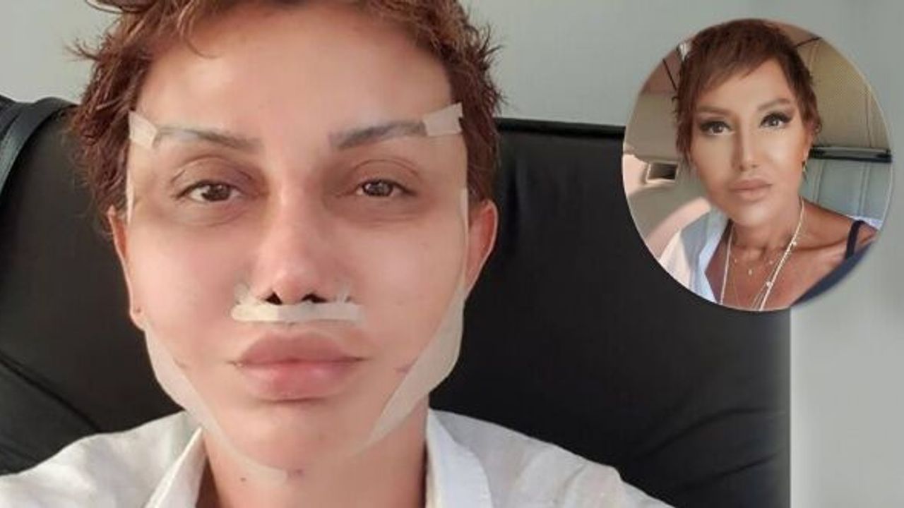 Serap Paköz, estetikten sonra yeni halini paylaştı!