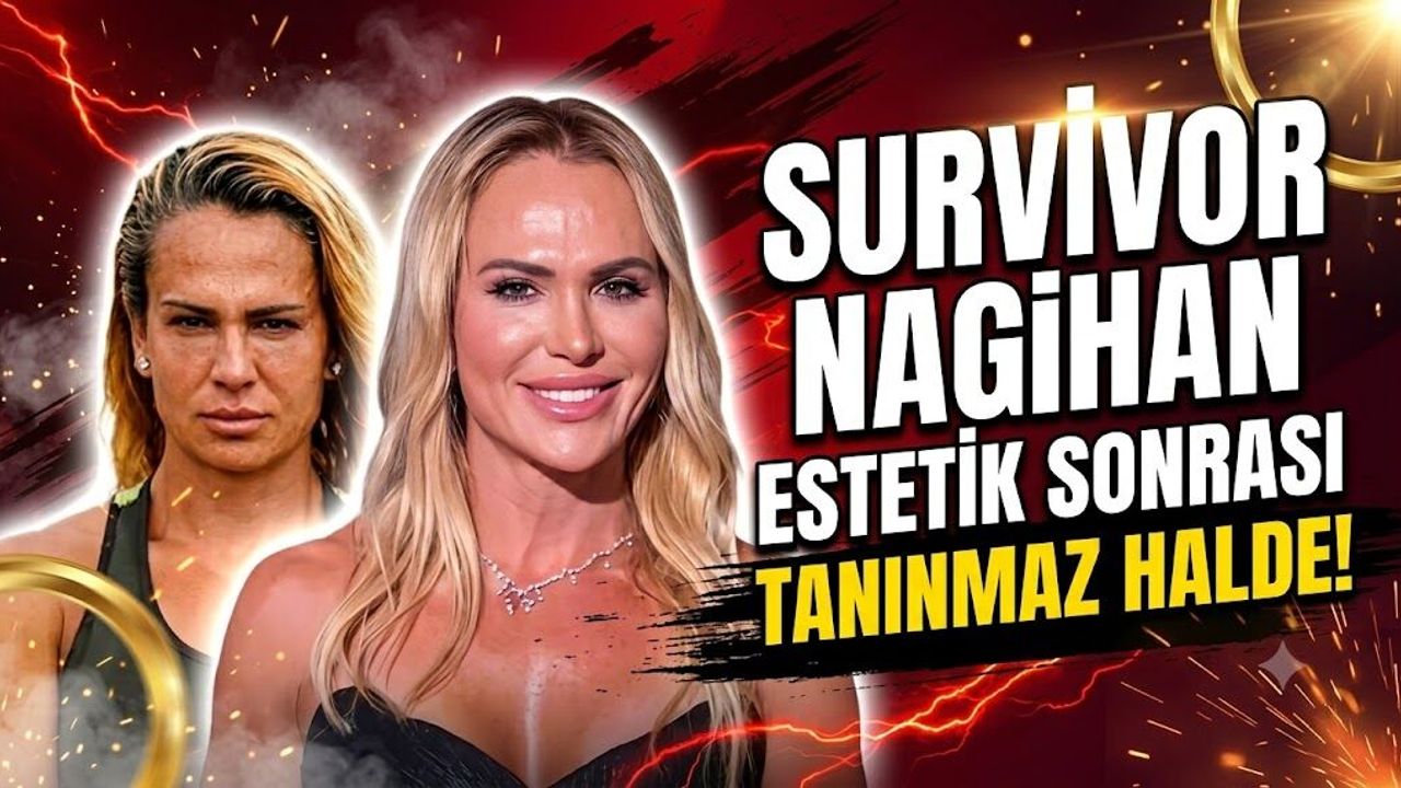 Survivor Nagihan estetik sonrası tanınmaz halde!
