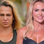 Survivor Nagihan Estetik Sonrası Tanınmaz Halde!