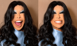 Bülent Ersoy'un Estetikli Son Hali Sosyal Medyayı İkiye Böldü! Lolita Oldum Dedi Ama...