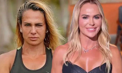 Survivor Nagihan Estetik Sonrası Tanınmaz Halde!