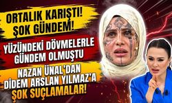 Yüzündeki Dövmelerle Gündem Olmuştu: Nazan Ünal'dan Didem Arslan Yılmaz'a Şok Suçlamalar!