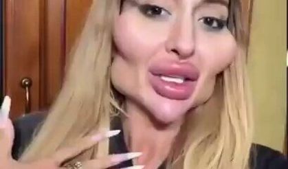 Estetikleri ile ünlenen Anastasia "Beni kıskanıyorlar!"