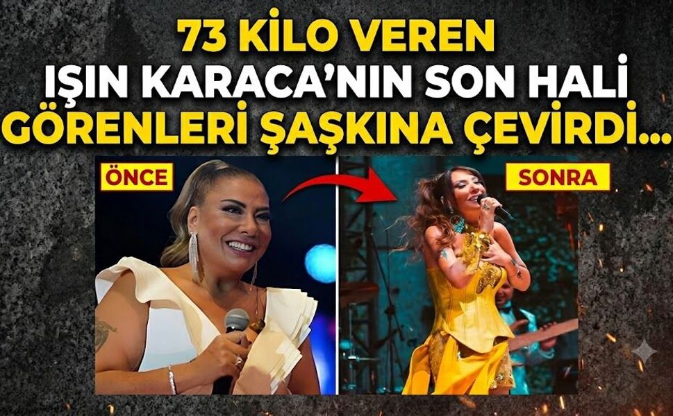 73 Kilo Veren Işın Karaca'nın Son Hali Görenleri Şaşkına Çevirdi