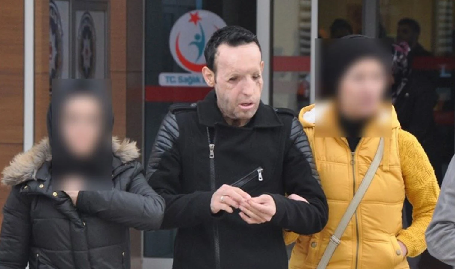 Yüz Nakli Recep
