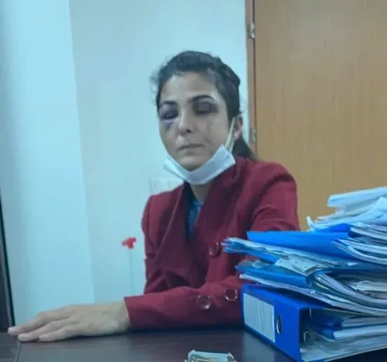 Melek İpek 2