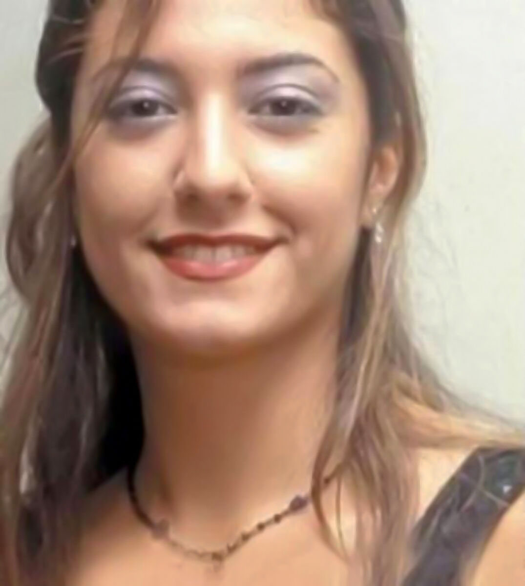 başak dizer estetiksiz