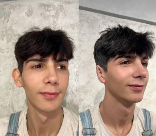 taha duymaz estetik