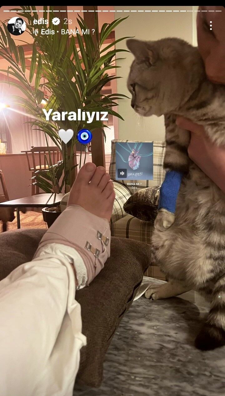 edis ayağından sakatlandı