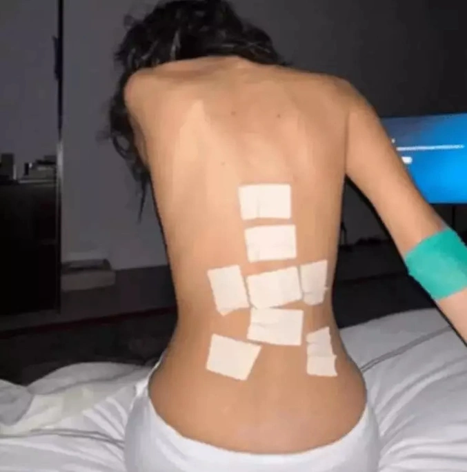 bella hadşd hastalığı