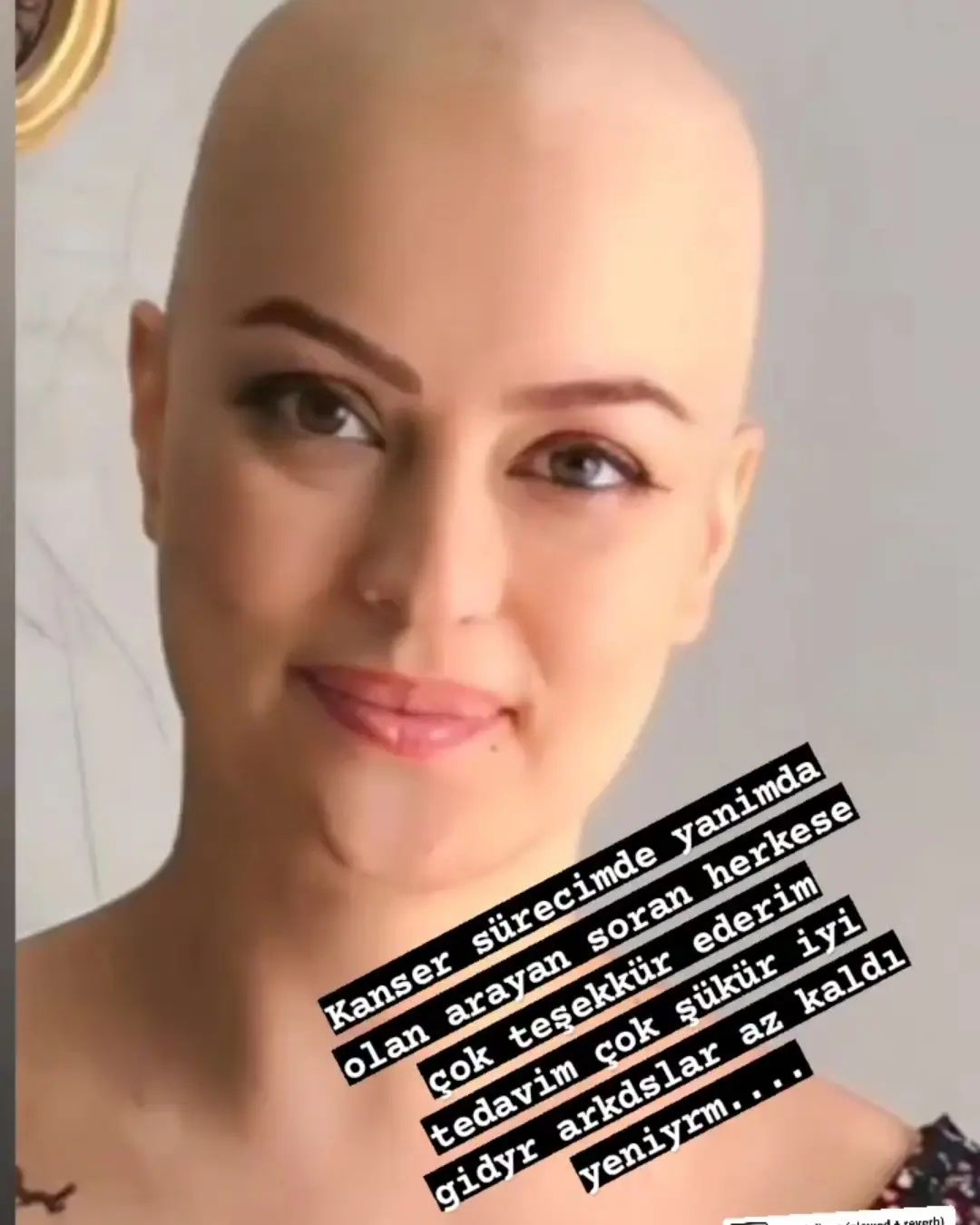 ayçin tuyun kanser (1)