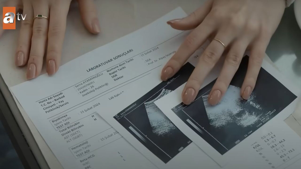 Aldatmak Dizisi Ultrason