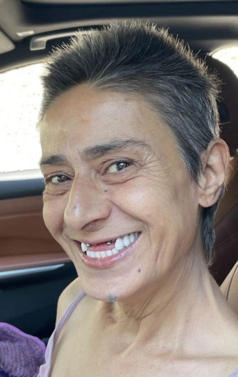 Yıldız Tilbe Dişsiz