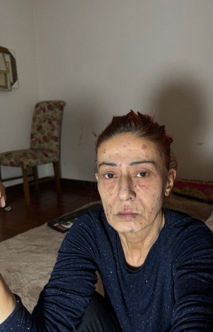 Yıldız Tilbe-5