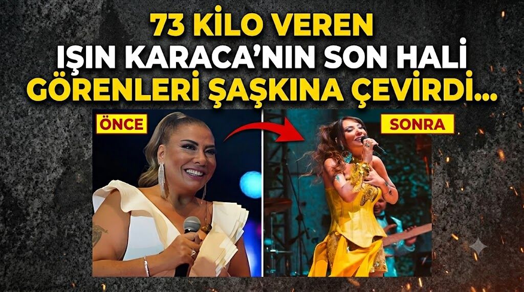 73 Kilo Veren Işın Karaca'nın Son Hali Görenleri Şaşkına Çevirdi