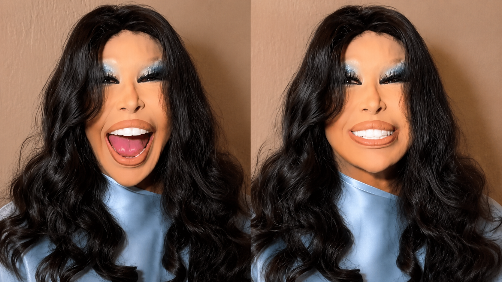 Bülent Ersoy'un Estetikli Son Hali Sosyal Medyayı İkiye Böldü! Lolita Oldum Dedi Ama...-1
