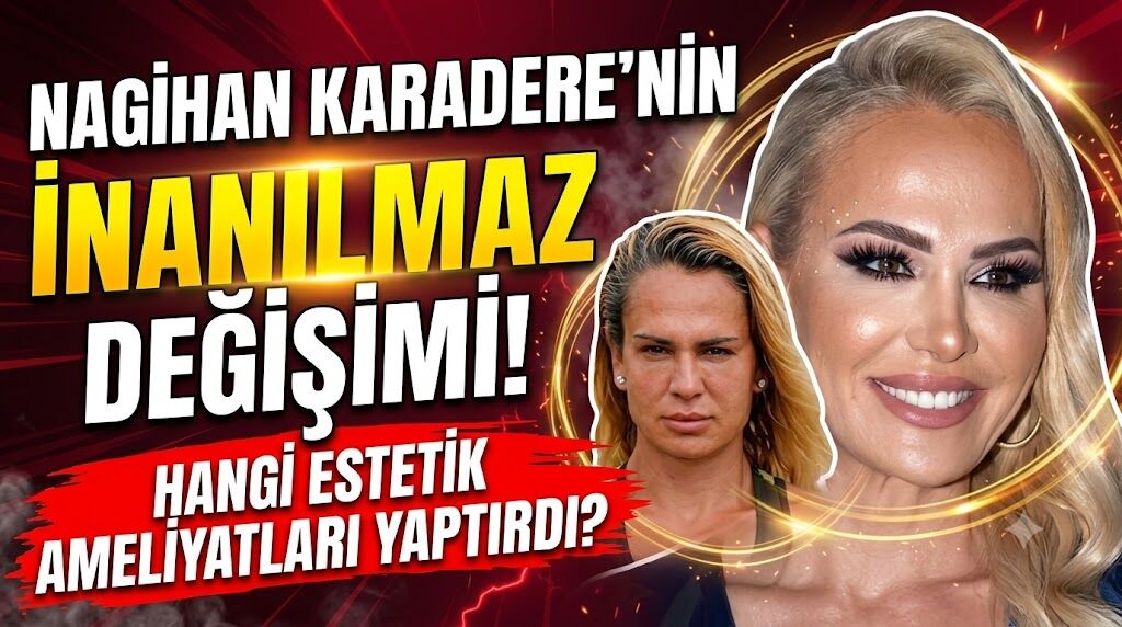 Nagihan Karadere'nin İnanılmaz Değişimi: Hangi Estetik Ameliyatları Yaptırdı?